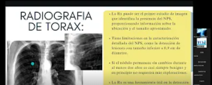 Monografía: Tórax Nódulo Pulmonar Solitario