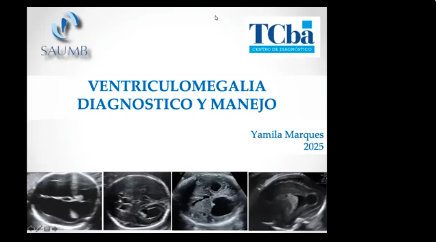 Clase Obstetricia: Ventriculomegalia Obstetricia