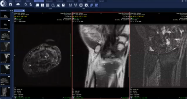 Articulaciones pequeñas