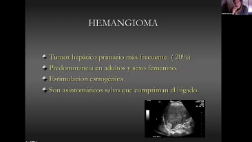 Trasplantes y tumores hepáticos - Dr. Alvarez