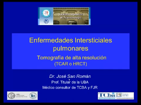 Intersticiopatías - Dr. San Roman
