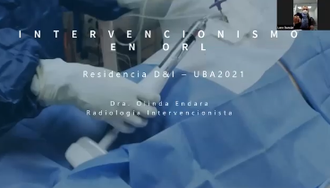 Intervencionismo de cuello