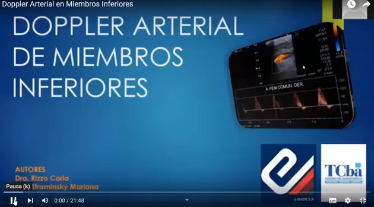 Ecodoppler arterial de miembros inferiores