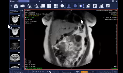 Ateneo Dr. San Roman 9/10/2025