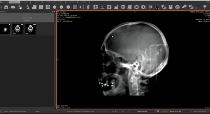 Ateneo Dr. San Román - 14/10/2025
