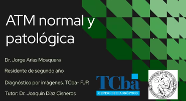 Monografía Dr. Arias, Jorge - ATM normal y patológica - 6/2/26