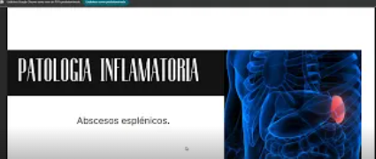 Clase: Patologías esplenicas - Dr. Victor Garcia