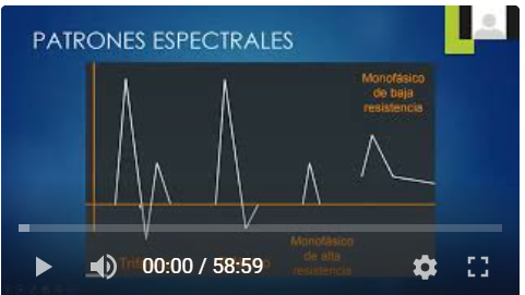 Doppler Arterial de MII