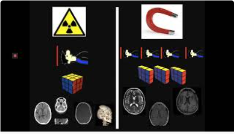 Neuro-radiología