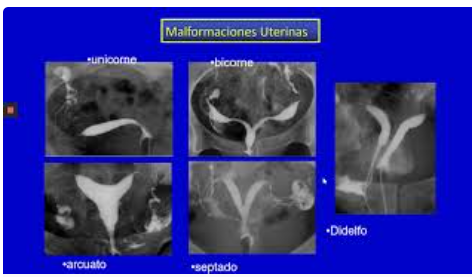 Generalidades ginecología y obstetricia