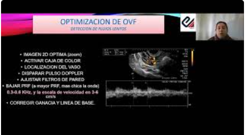 Flujometría Doppler