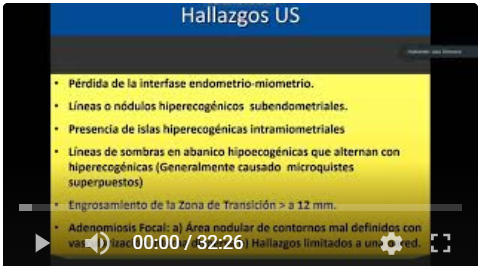 Diagnóstico ecográfico de adenomiosis