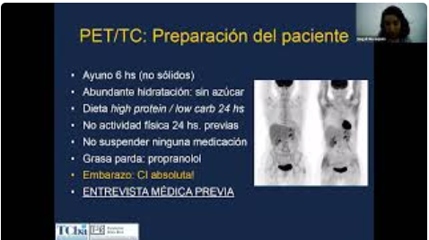 Curso ORL - Patología oncológica cyc PET