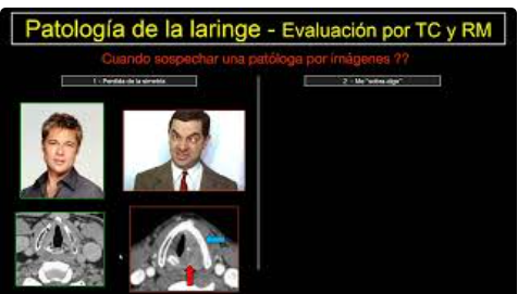 Curso ORL - Anatomía y patología Laringe