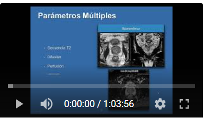 RMN Multiparamétrica próstata