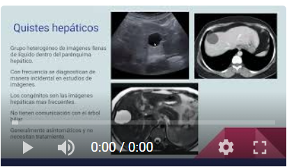 Imágenes focales hepáticas y protocolos específicos