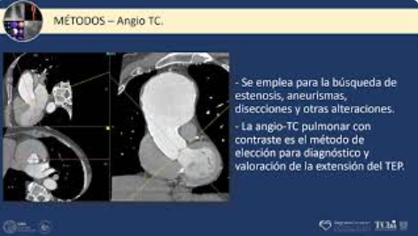 Generalidades Cardiovascular