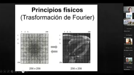 Resonancia Magnética Cardíaca