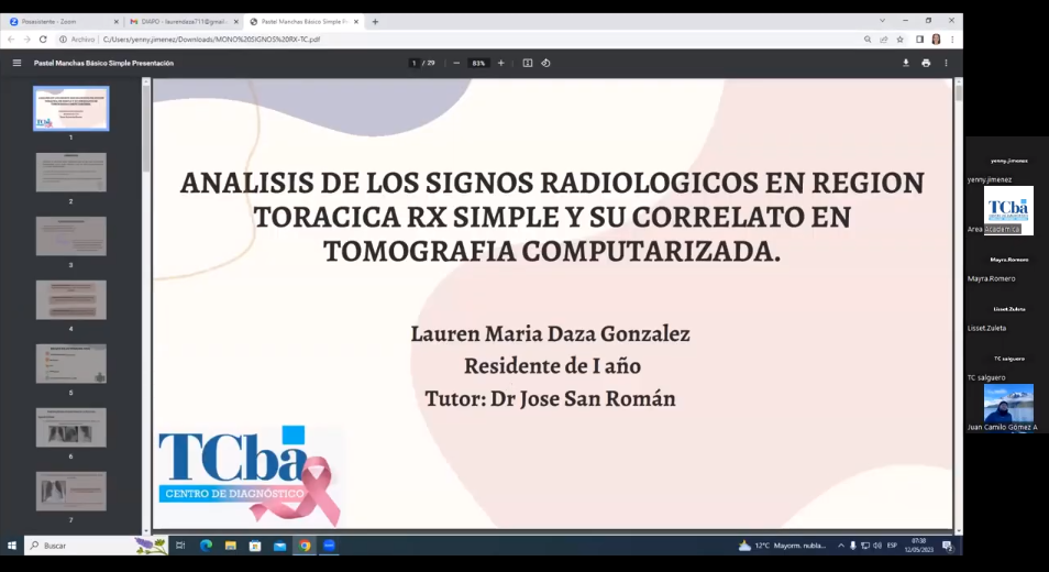 Análisis de los signos radiológicos en región torácica RX simple y su correlato en TC