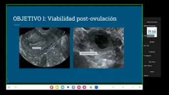 Ecografía del Primer Trimestre 