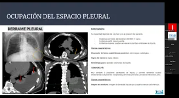 Patología Pleural, pared torácica y diafragmatic