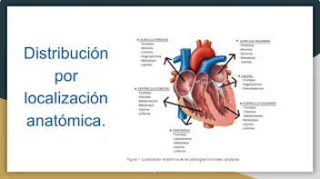 Tumores Cardiacos por Rmn - Dra. Nathalia Muñoz