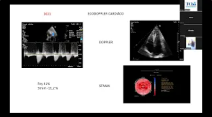 Amiloidosis: Ateneo Multidisciplinario